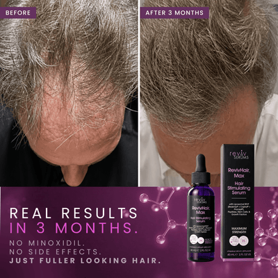 RevivHair Max Hair Stimulating Serum with 5% Redensyl, RCP, KGF, & Copper Peptides