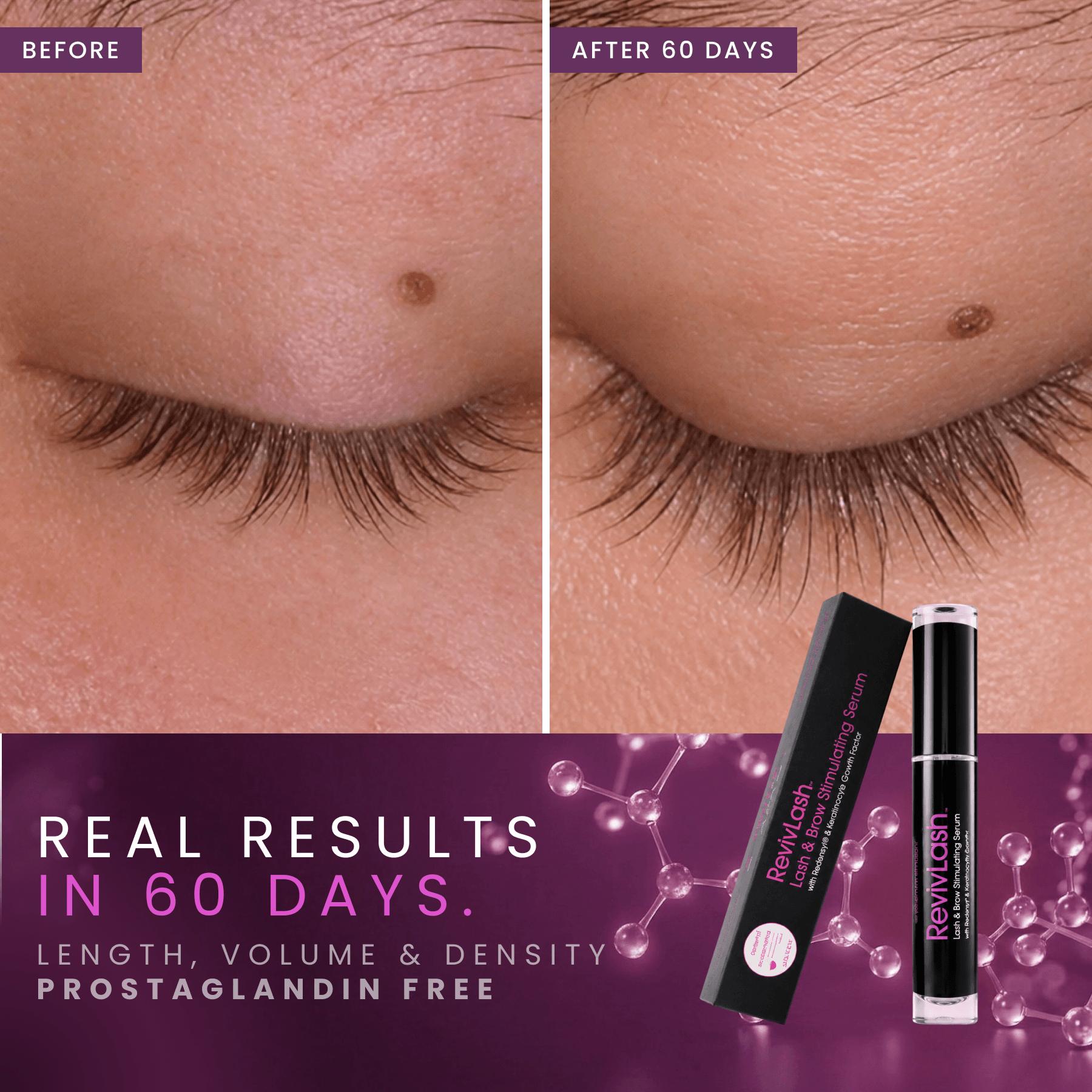 RevivLash Lash & Brow Stimulating Serum with Redensyl, KGF & Peptides