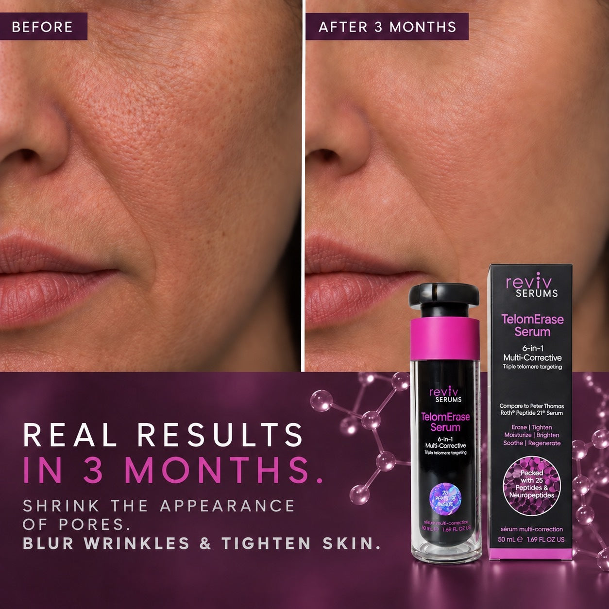 TelomErase 6-in-1 Multi-Corrective Serum