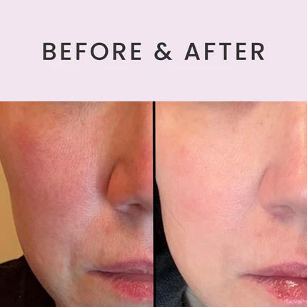 Ultimate Serum with Exosomes, Growth Factors & Peptides