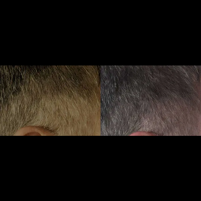 glutathione grey hair reddit Be honest, have you had work? 11 people open up about what they do or don't do to their face | Beauty I've worked with patients who