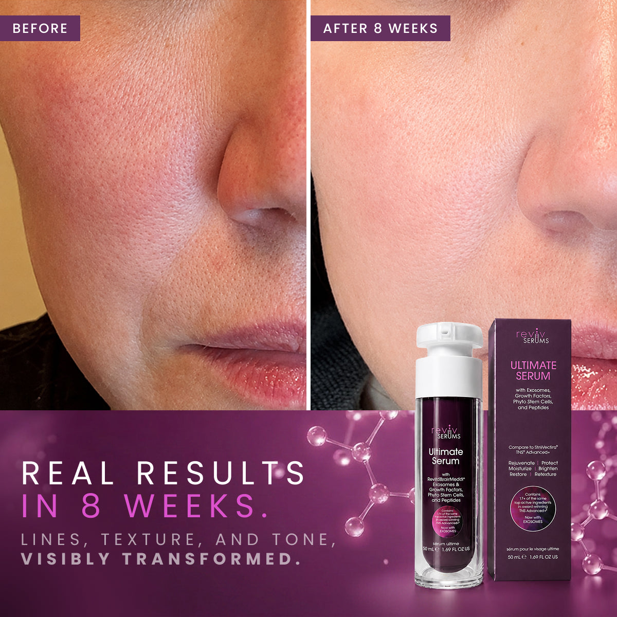 Large Pores – RevivSerums.com