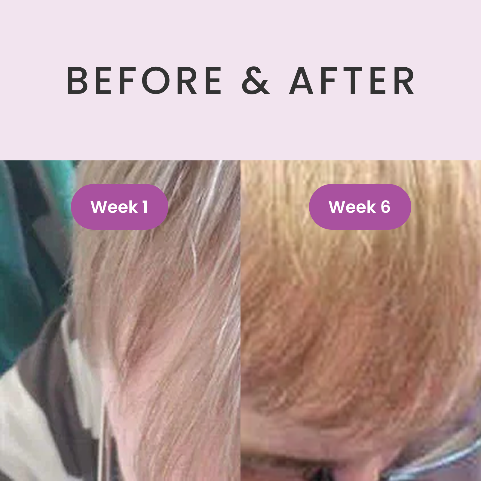 RevivHair REV Advanced: Grey Hair Reverse Serum with MelanoGray & Greyverse