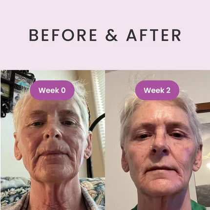 Ultimate Serum with Exosomes, Growth Factors & Peptides